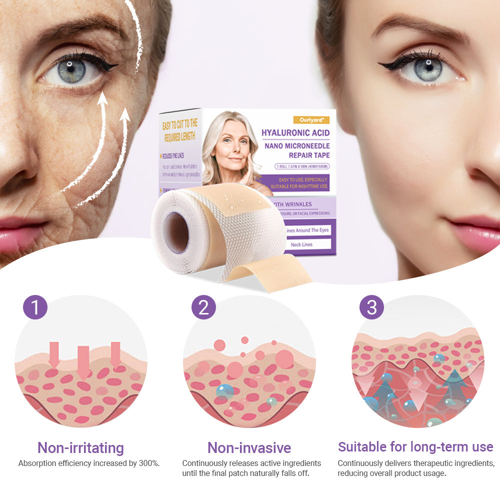 ✅Official Store | Ourlyard® Hyaluronic Acid Nano Microneedle Repair Tape 🦘✴️(Repairs wrinkles, fine lines, skin laxity, etc., suitable for multiple areas such as the face, hands, abdomen, legs – 4cm x 150 cm roll)