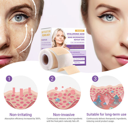 ✅Official Store | Ourlyard® Hyaluronic Acid Nano Microneedle Repair Tape 🦘✴️(Repairs wrinkles, fine lines, skin laxity, etc., suitable for multiple areas such as the face, hands, abdomen, legs – 4cm x 150 cm roll)