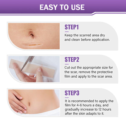 ✅ TGA Approved | Ourlyard® Hyaluronic Acid Nano Microneedle Repair Tape🦘🍀 (Effective in fading various types of scars, including surgical scars, burn scars, acne scars, and stretch marks, while improving uneven skin tone and skin imperfections.)