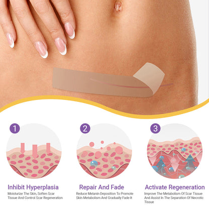 ✅ TGA Approved | Ourlyard® Hyaluronic Acid Nano Microneedle Repair Tape🦘🍀 (Effective in fading various types of scars, including surgical scars, burn scars, acne scars, and stretch marks, while improving uneven skin tone and skin imperfections.)