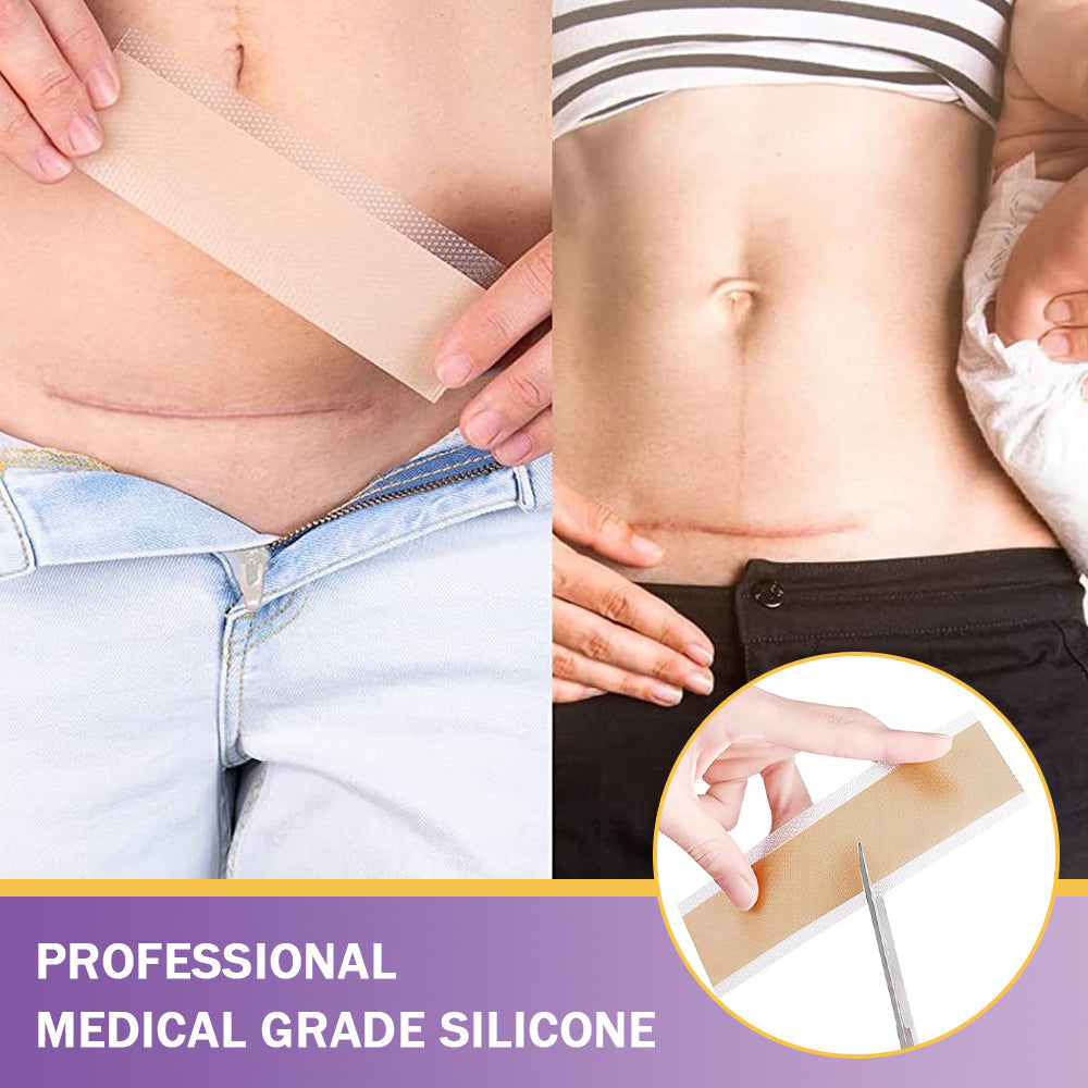 ✅ TGA Approved | Ourlyard® Hyaluronic Acid Nano Microneedle Repair Tape🦘🍀 (Effective in fading various types of scars, including surgical scars, burn scars, acne scars, and stretch marks, while improving uneven skin tone and skin imperfections.)